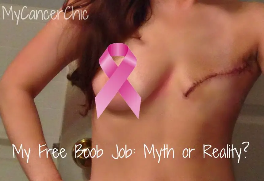 Breast Reconstruction Feature Image