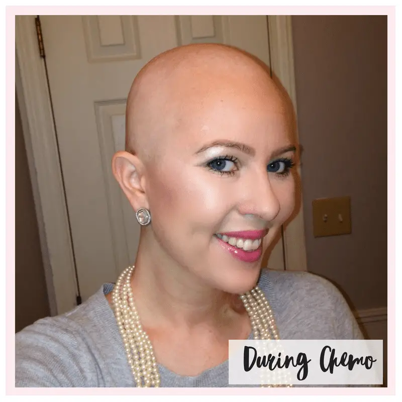 My Cancer Chic Post Chemo Hair Growth Timeline 5600