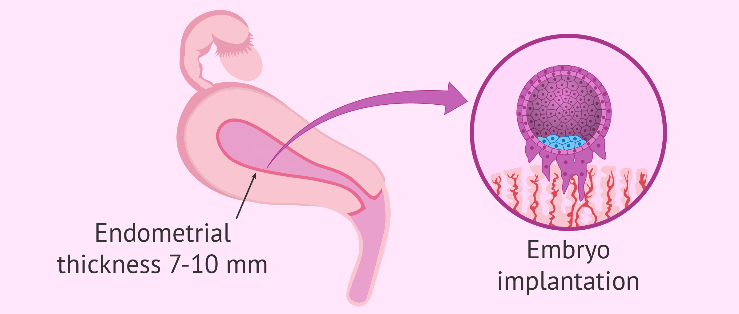 Frozen Embryo Transfer Cycle: Week 2 Reflections - My Cancer Chic