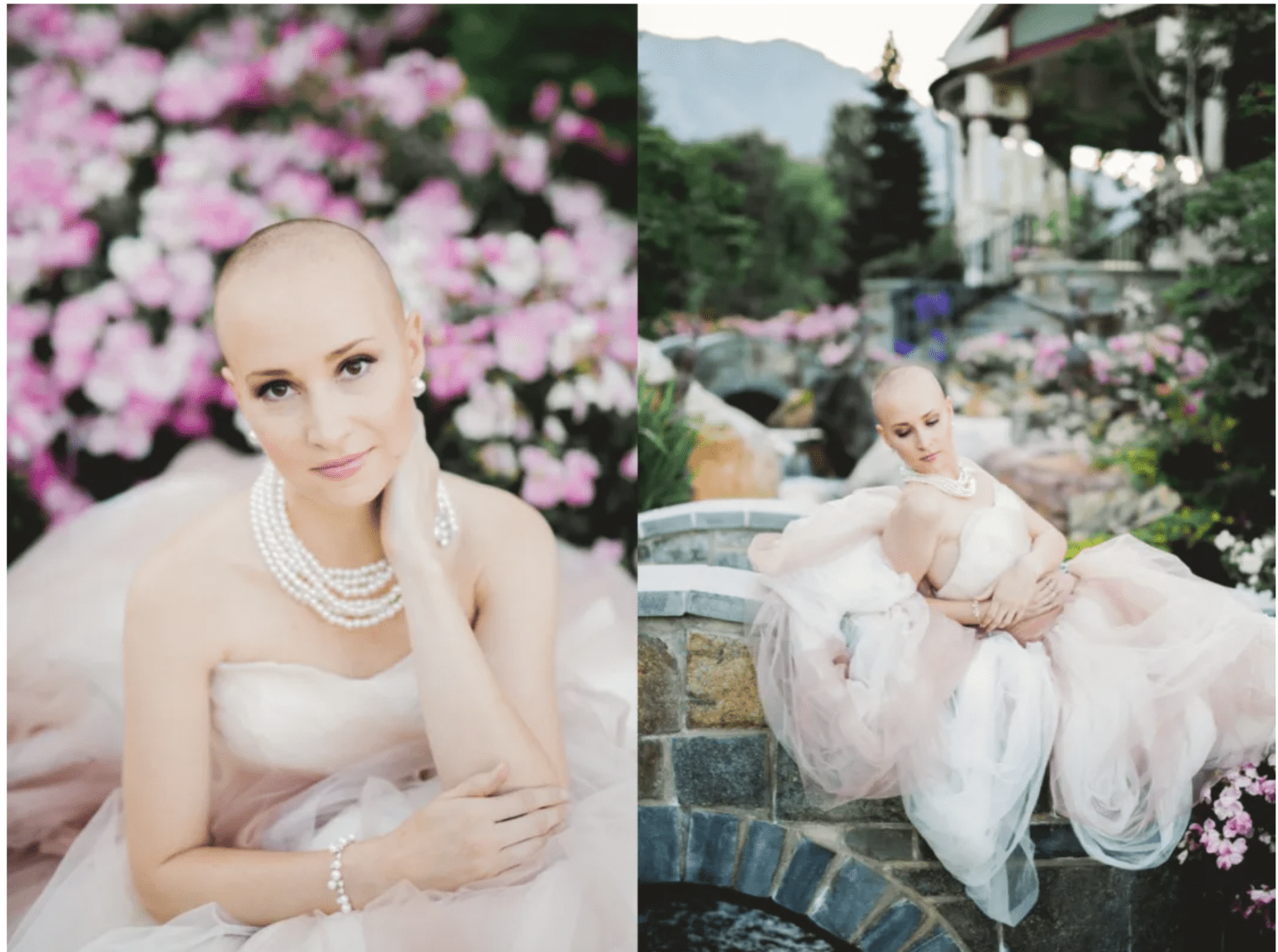 11 Breast Cancer Photoshoot Ideas Youll Love 2024 7325